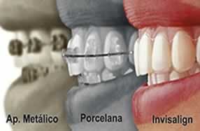 Ortodontia - Oral Ipanpema